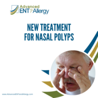 New Treatment for Nasal Polyps